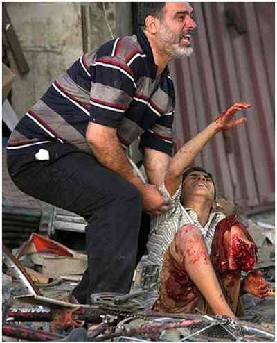 Palestine Occupee - jeune adolescent Palestinien la jambe coupée et des doigts emportés par des éclats d'obus, son père appelant à l'aide
