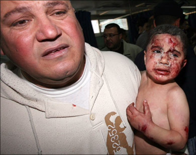 Palestine Occupee - bébé blessé au visage lors de bombardements sur Gaza, affliction et détresse dans le regard de son père